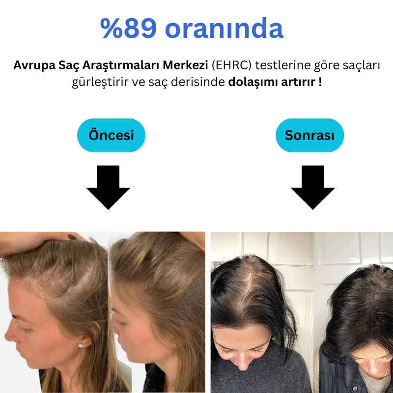 HomeFresh Filtreli Duş Başlığı