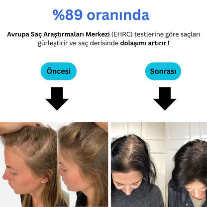 HomeFresh Filtreli Duş Başlığı